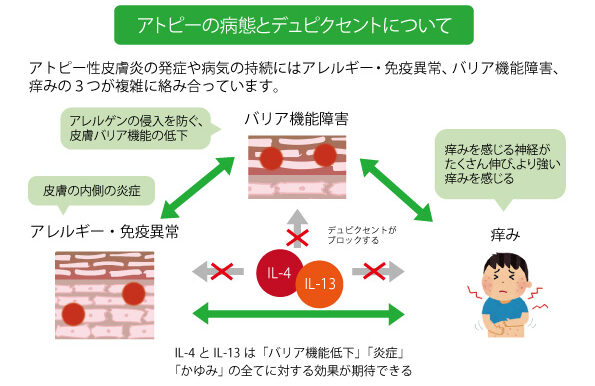 アトピーの病態とデュピクセントについて